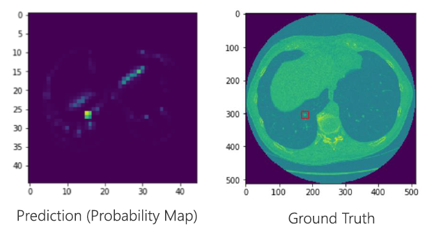 Medical image processing using Microsoft Deep Learning Framework(CNTK ...