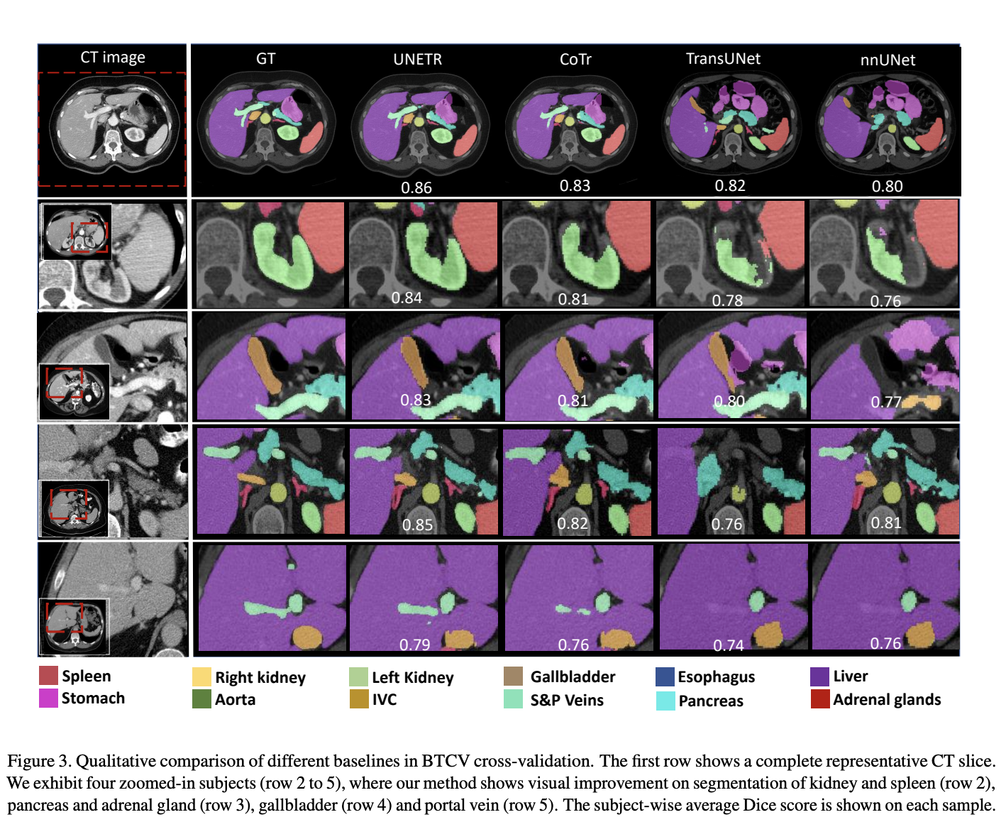UNETR: Transformers for 3D Medical Image Segmentation