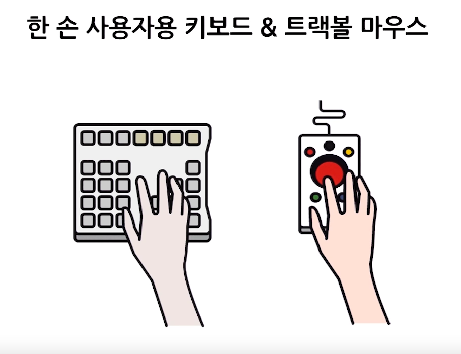 손 운동 장애 보조 기기