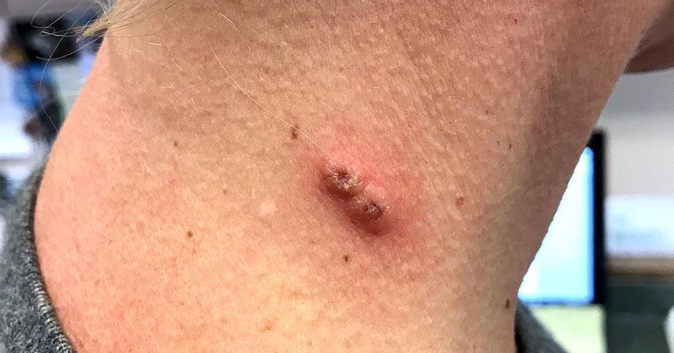 post-thumbnail