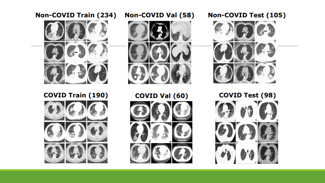 COVID-19 Detection Using CT SCAN