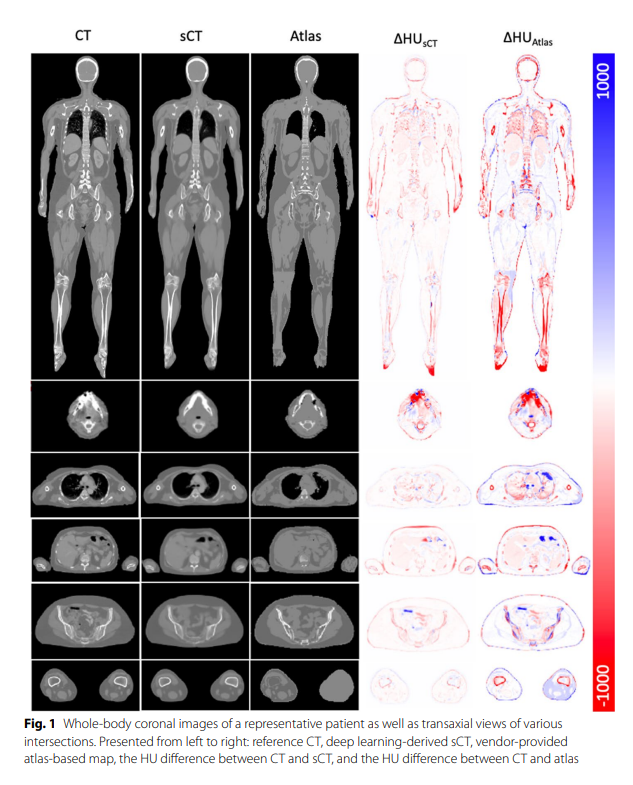 A deep learning‑based whole‑body solution for PET/MRI attenuation ...