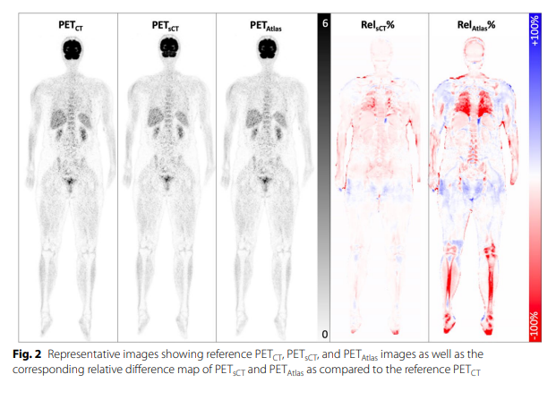A deep learning‑based whole‑body solution for PET/MRI attenuation ...