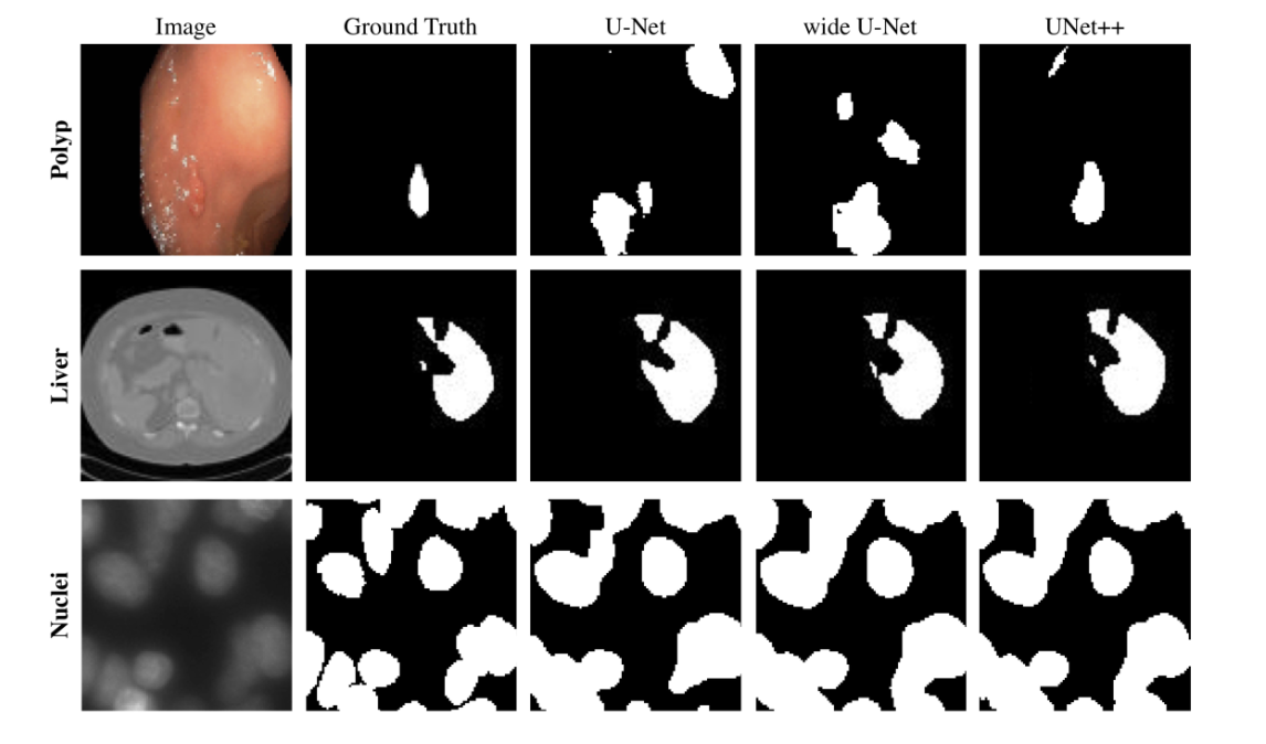 [논문 리뷰] UNet++: A Nested U-Net Architecture for Medical Image Segmentation