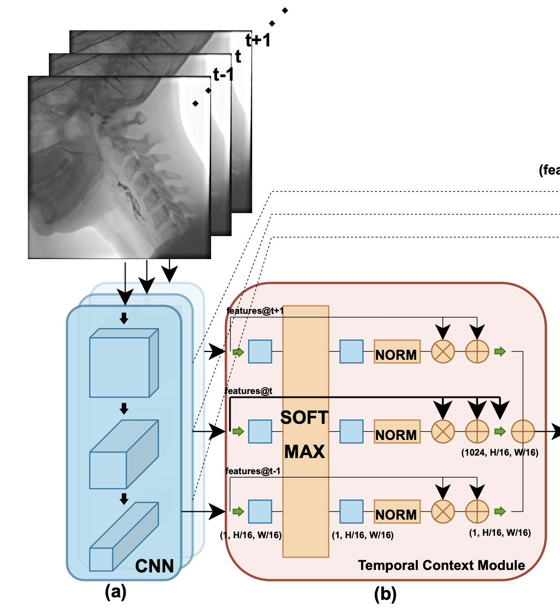 [논문리뷰] Video-TransUNet: Temporally Blended Vision Transformer for CT ...